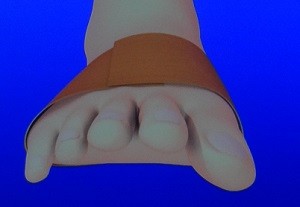 テーピングで痩せる