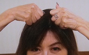 おでこのシワ消し